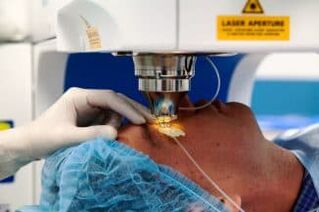 Laser vision operation