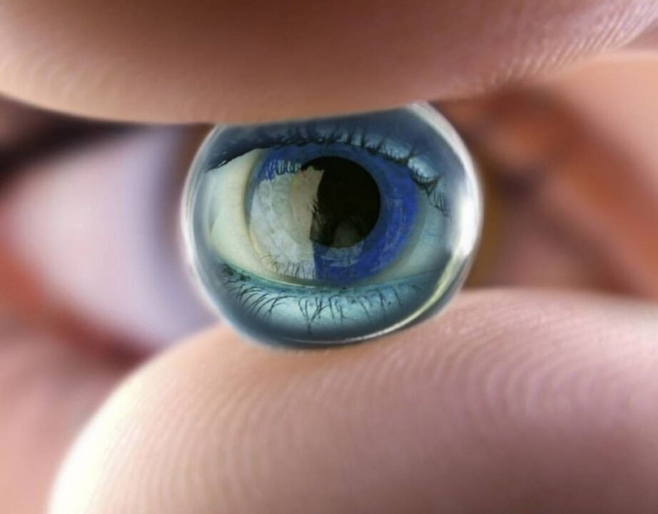 Orthokeratology night lenses will stop the progression of visual impairment